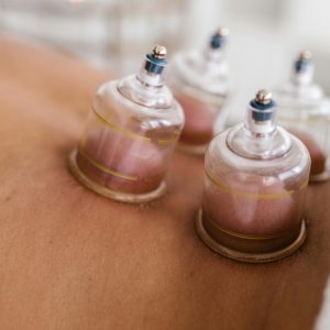 cupping massage